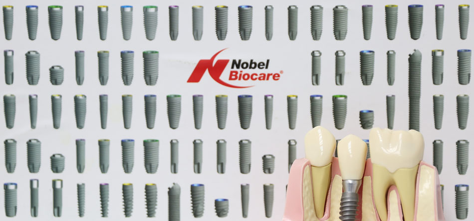 All-on-4 by Nobel Biocare