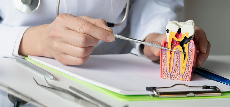 aesthetics title Root canal treatment