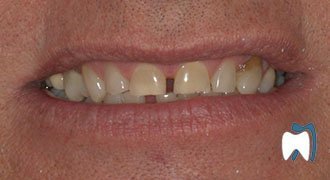Cosmetic dentistry case study 12 — before treatment