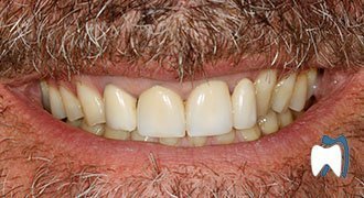 Cosmetic dentistry case study 15 — before treatment