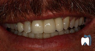 Cosmetic dentistry case study 16 — after treatment