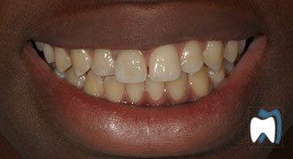 Cosmetic dentistry case study 17 — after treatment