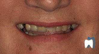 Cosmetic dentistry case study 7 — before treatment