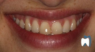Cosmetic dentistry case study 9 — before treatment