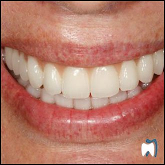 Smile result from the practice