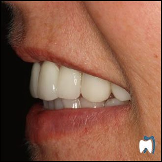 Smile result from the practice